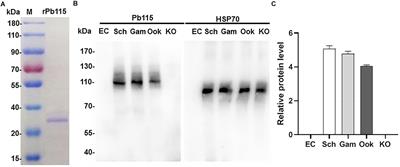 An MFS-Domain Protein Pb115 Plays a Critical Role in Gamete Fertilization of the Malaria Parasite Plasmodium berghei